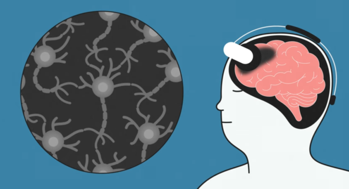 Illustration of a person with a head set on from flow neuroscience